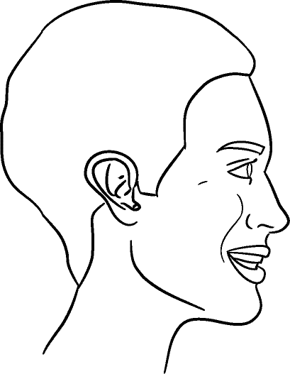 Line drawing of Right profile (subject is facing observer's right) - Full Smile, Centric Occlusion