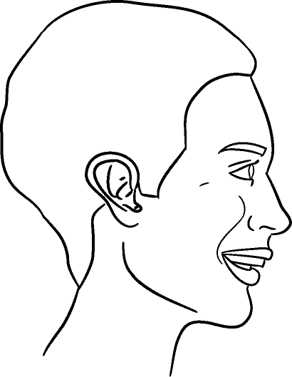 Line drawing of Right Profile (subject is facing observer's right) - Full Smile, Centric Relation