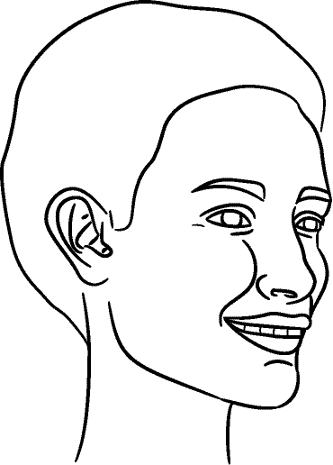 Line drawing of 45° Right Profile (subject turns toward observer's right) - Full Smile, Centric Occlusion