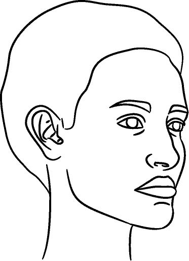 Line drawing of 45° Right Profile (subject turns toward observer's right) - Mandible Postured Forward