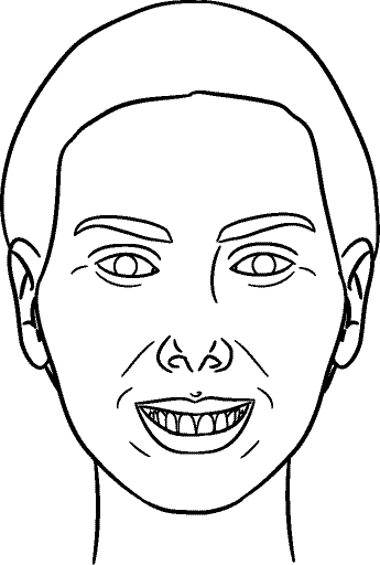 Line drawing of Full Face - Full Smile, Centric Occlusion