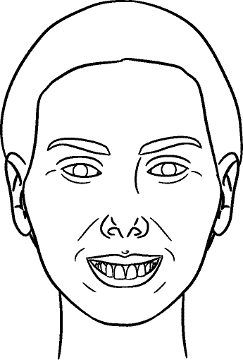 Line drawing of Full Face - Full Smile, Centric Relation