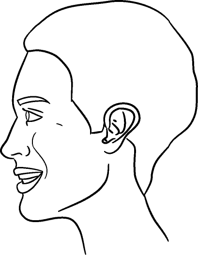 Line drawing of Left profile (subject is facing observer's left) - Full Smile, Centric Occlusion