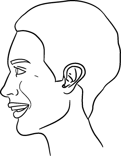 Line drawing of Left Profile (subject is facing observer's left) - Full Smile, Centric Relation