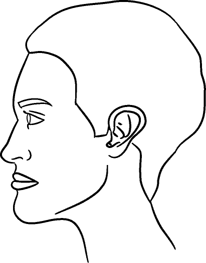 Line drawing of Left Profile (subject is facing observer's left) - Mandible Postured Forward