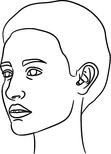 Line drawing of 45° Left Profile (subject turns toward observer's left) - Lips Relaxed, Centric Occlusion