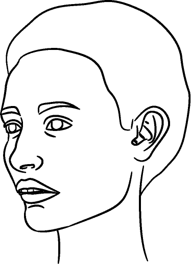 Line drawing of 45° Left Profile (subject turns toward observer's left) - Lips Relaxed, Centric Relation