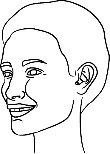 Line drawing of 45° Left Profile (subject turns toward observer's left) - Full Smile, Centric Occlusion