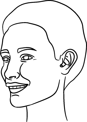 Line drawing of 45° Left Profile (subject turns toward observer's left) - Full Smile, Centric Relation