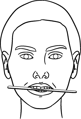 Line drawing of Other Face - Occlusal Cant ( e.g., tongue depressor)