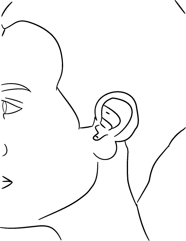 Line drawing of Other Face - Anomalies (ears, skin tags, etc.)