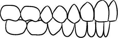 Line drawing of Intraoral Right Buccal Segment, Centric Occlusion, Direct View