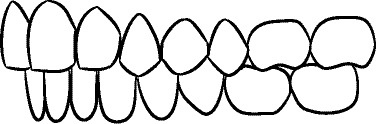 Line drawing of Intraoral Right Buccal Segment - Centric Occlusion, With Mirror