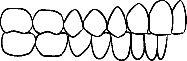 Line drawing of Intraoral Right Buccal Segment - Centric Relation, Without Mirror