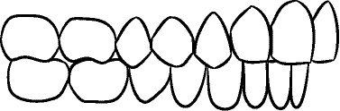 Line drawing of Intraoral Right Buccal Segment - Centric Relation, With Mirror But Corrected