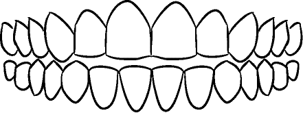 Line drawing of Intraoral Frontal View - Teeth Apart, Without Mirror