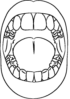 Line drawing of Intraoral Frontal View - Mouth Open, Without Mirror