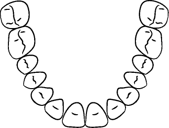 Line drawing of Intraoral Maxillary Occlusal View - Mouth Open, With Mirror