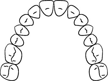 Line drawing of Intraoral Maxillary Occlusal View - Mouth Open, With Mirror But Corrected