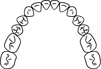 Line drawing of Intraoral Mandibular Occlusal View - Mouth Open, With Mirror